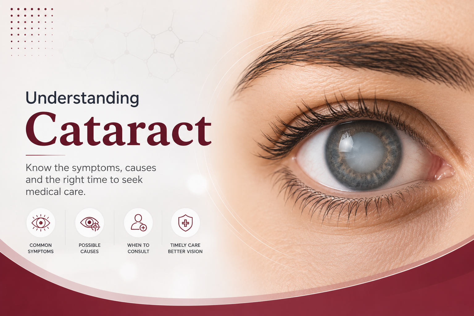 What is Cataract? Symptoms, causes and when to consult